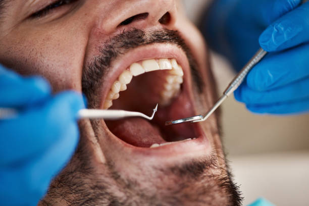 Best Emergency Root Canal Treatment in Berryville, TX